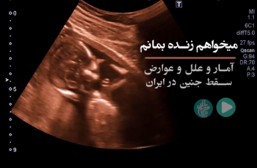 آمار، علل و عوارض سقط جنین در ایران